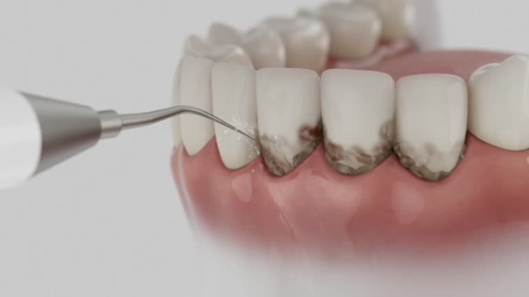 Reliable Teeth Cleaning And Checkup contractor in Michigan, MI by Dentist Open Now